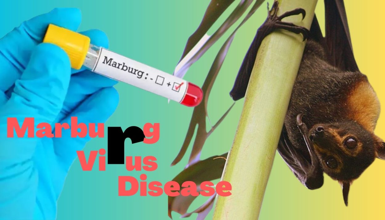 Exploring Marburg Virus Disease