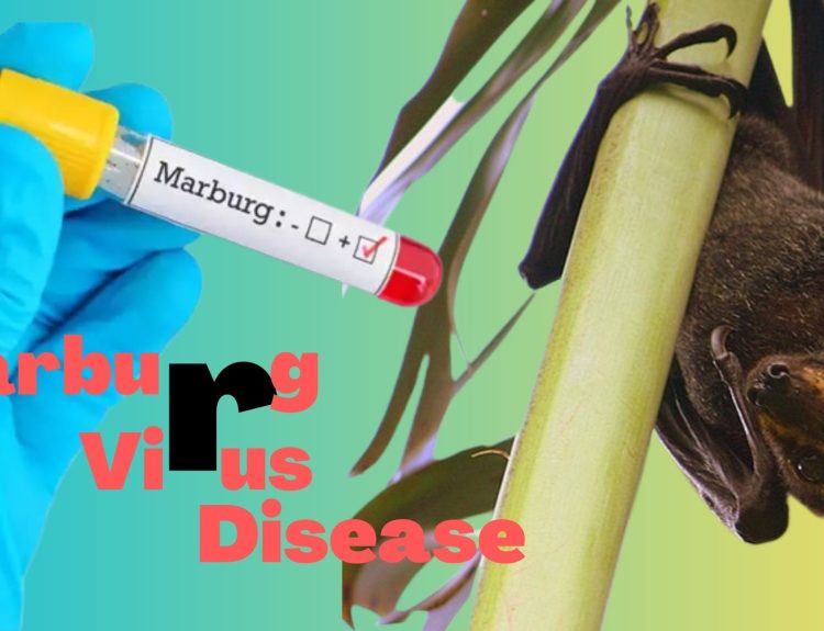 Exploring Marburg Virus Disease