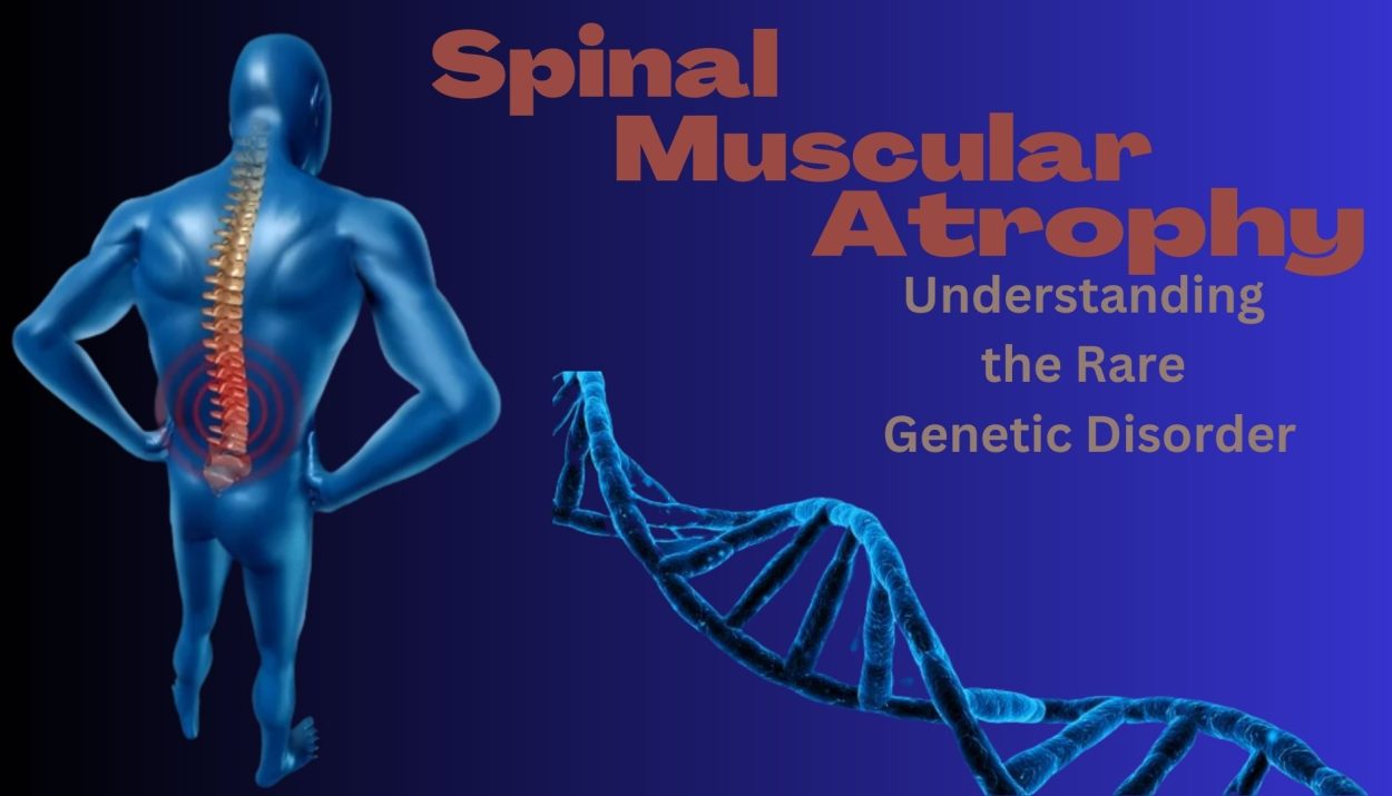 Spinal Muscular Atrophy: Understanding the Rare Genetic Disorder
