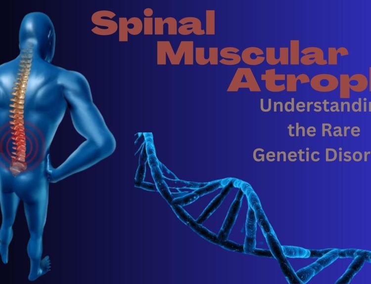 Spinal Muscular Atrophy: Understanding the Rare Genetic Disorder