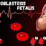 Erythroblastosis Fetalis