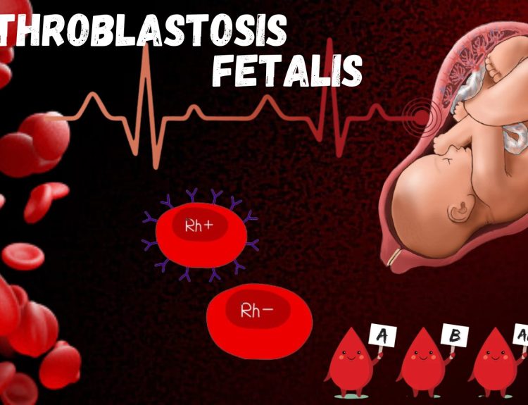 Erythroblastosis Fetalis